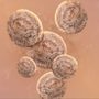 Photo of Blume Bakery