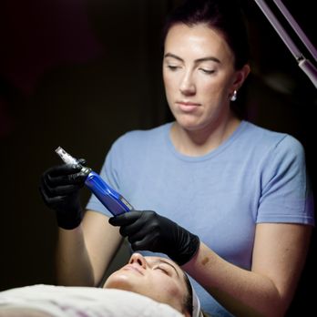 Amazon Aesthetics and Laser - SkinPen Microneedling - Estheticians Near Me - Frisco, Texas Amazon Aesthetics and Laser - SkinPen Microneedling - Estheticians Near Me - Frisco, Texas