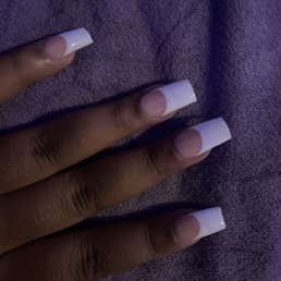 there chips stained coloring and uneven nails there chips stained coloring and uneven nails