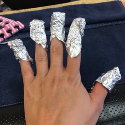 Gel removal