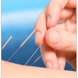 Acupuncture & Herbs