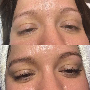Honey Skin Spa - Before and after an eyebrow tint and wax, eyelash tint and lift, and an oxygen facial. - Eyelash Service Near Me - Seattle, Washington Honey Skin Spa - Before and after an eyebrow tint and wax, eyelash tint and lift, and an oxygen facial. - Eyelash Service Near Me - Seattle, Washington