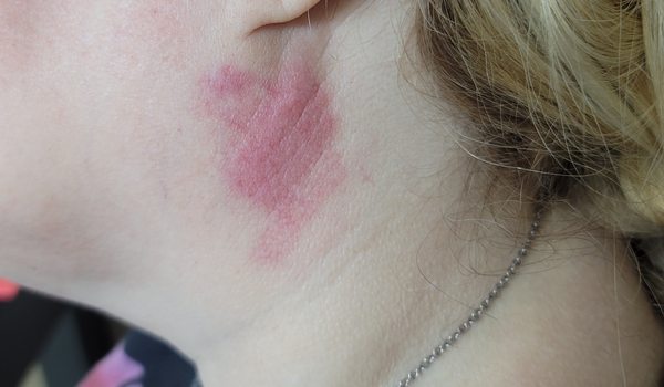 Affordable Dentures & Implants