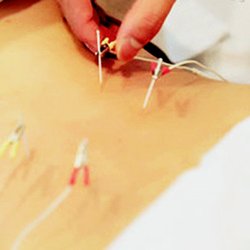 Dr Shi Acupuncture Center