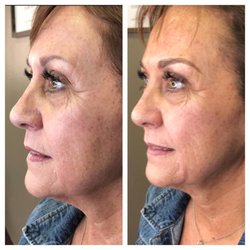 Elite Microblading and Cosmetics
