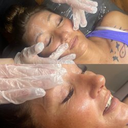 Plush Studios & Medical Aesthetics - Procell Therapies Microchanneling
