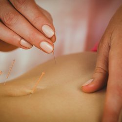 Calandra Center for Health and Wellness - Acupuncture for Fertility