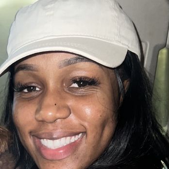 BareMer Spa - After starting treatments - Skin Care Near Me - Atlanta, Georgia