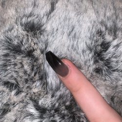 Ky & Julie Spa - Finger wound