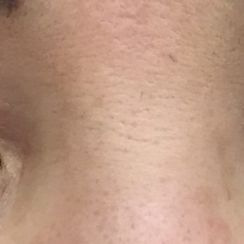 Permanent Makeup By Jennifer - CLIENT E LOWER LINER POST - Makeup Artists Near Me - San Jose, California Permanent Makeup By Jennifer - CLIENT E LOWER LINER POST - Makeup Artists Near Me - San Jose, California