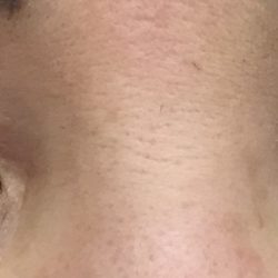 Permanent Makeup By Jennifer - CLIENT E LOWER LINER POST