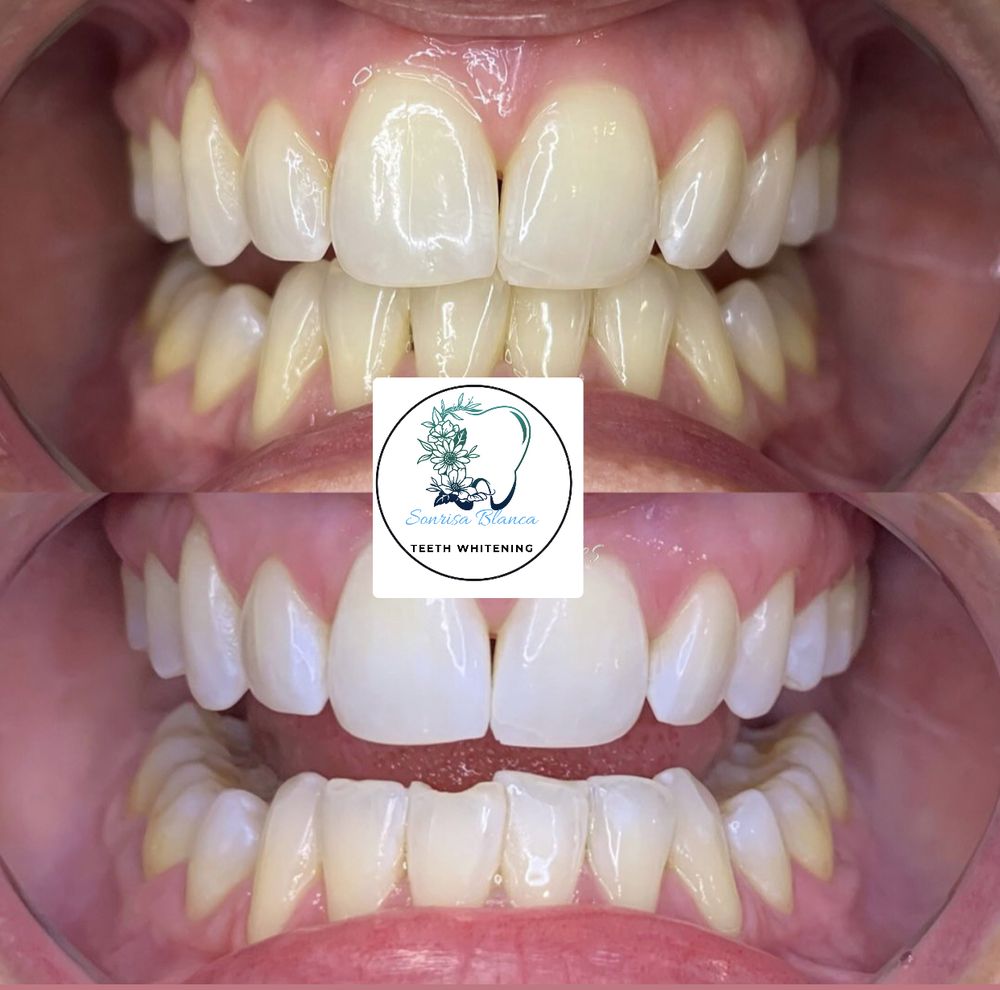 Sonrisa Blanca Logo
