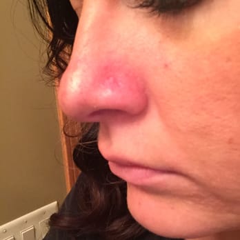 Dzul Ink Lounge - Horrible nose piercing experience - Tattoo Near Me - Seattle, Washington Dzul Ink Lounge - Horrible nose piercing experience - Tattoo Near Me - Seattle, Washington