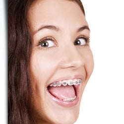 Archstone Dental & Orthodontics - Weatherford - Braces Weatherford, TX