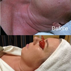 Color + Image Studio - Radiancy Sun-damage removal