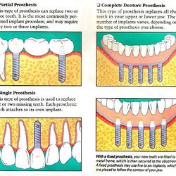 Hoffman Charles, DDS