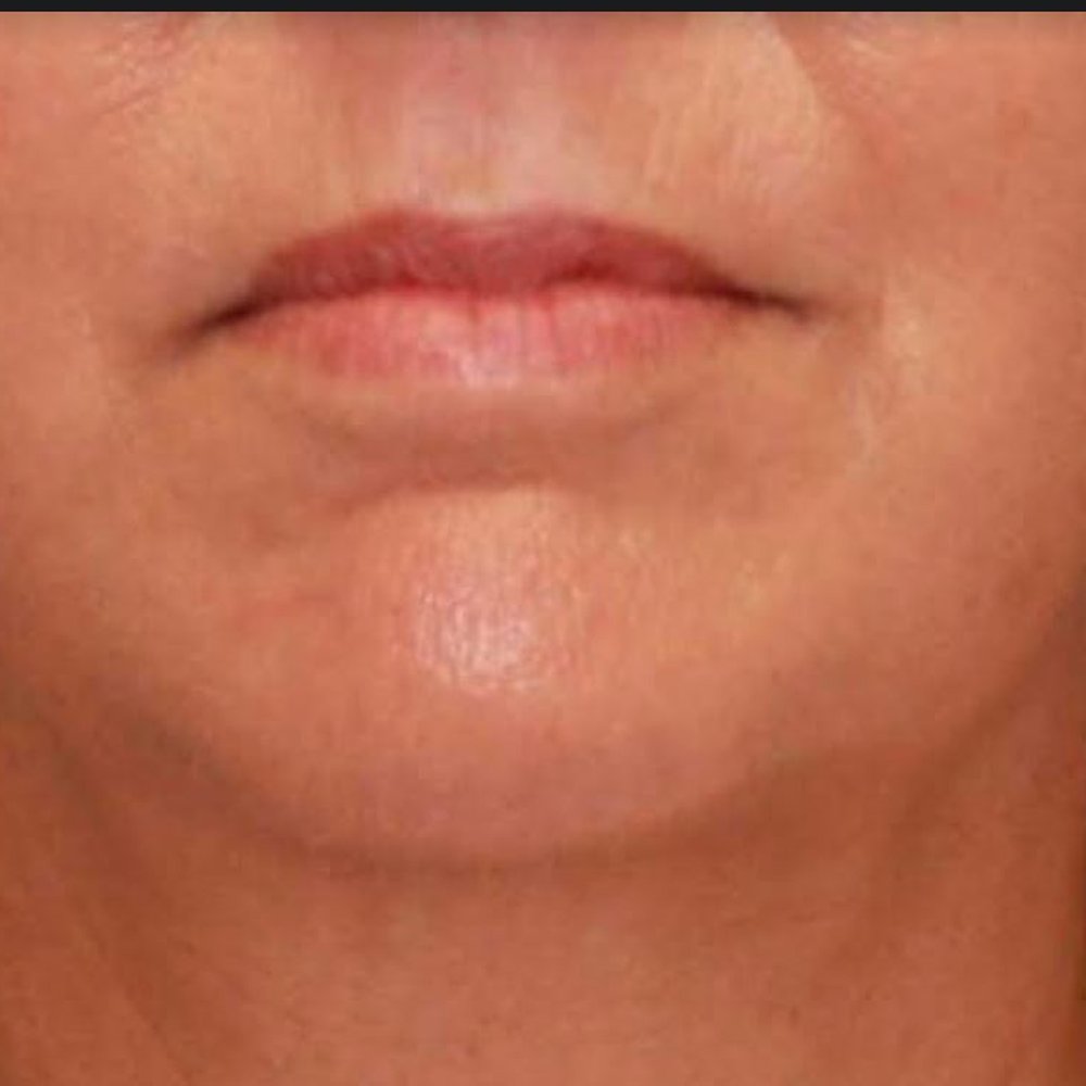 John W Tyrone, MD - This is my mouth BEFORE - Cosmetic Surgeons Near Me - Gainesville, Florida John W Tyrone, MD - This is my mouth BEFORE - Cosmetic Surgeons Near Me - Gainesville, Florida