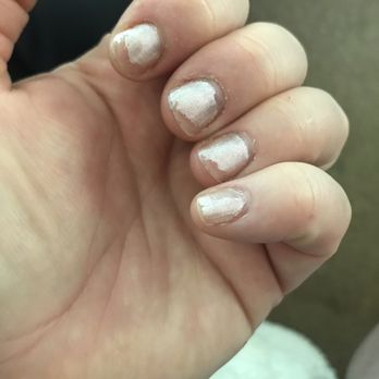 Spa Elysee - 3 days after mani - Skin Care Near Me - Burlingame, California