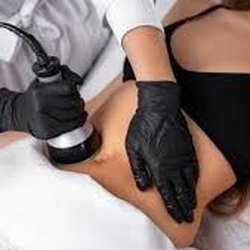 Epiluxe Aesthetics - Sculpt & slim with body cavitation--non-invasive fat reduction for smoother curves & tighter skin. No downtime, just results!