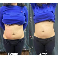 Body By J&S - Ultrasound cavitation
Lose 1-2 inches per session