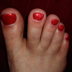 Nail Fairy - Close up of my nails with dry skin and uneven edges.