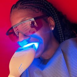 Whitening
