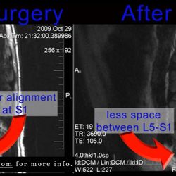 Duncan McBride, MD - Operations that leave the patient in worse condition are "acceptable" outcomes, according to UCLA.