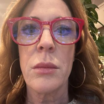 South Bay Med Spa - Bonnie's lip work!!!! - Medical Spas Near Me - Torrance, California