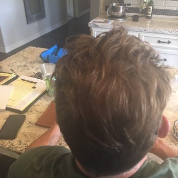 Neopel - 13 months after. Thank you thank you thank you! - Hair Loss Centers Near Me - Tijuana, BCN