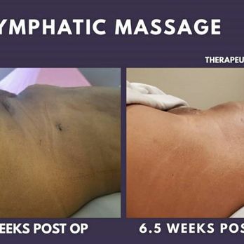 Mbode Recovery - Post Op recovery - Massage Therapy Near Me - Marietta, Georgia