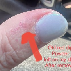 Lux Nails Spa - Residue on my skin of the red dip powder that was removed.