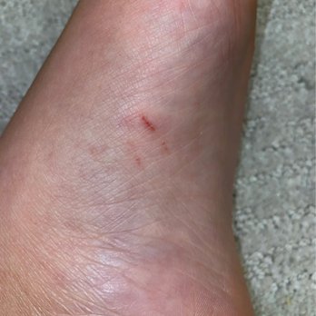 Cosmo Nail Bar - Foot with cuts - Nail Salons Near Me - Annapolis, Maryland