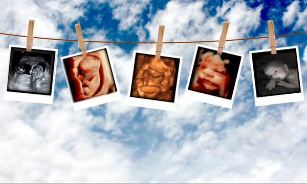 Mommy and Me 3D/4D Ultrasound