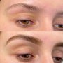 Photo of Supraorbital Beauty