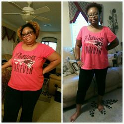 Carolinas Weight Management & Wellness Center - It's the before and after surgery pic. It's the same shirt, amazing. Surgery year, 2015.