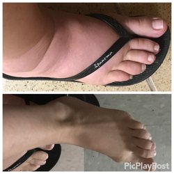Edward C Spoon Jr., MD FACOG FACS - Dr. Spoon said I wasn't swollen & ignored my eclampsia Sx.