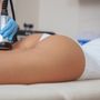 MyProSculpt