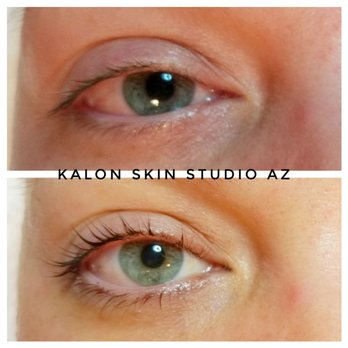 Kalon Skin Studio - Elleebana lash lift - Aestheticians Near Me - Gilbert, Arizona Kalon Skin Studio - Elleebana lash lift - Aestheticians Near Me - Gilbert, Arizona