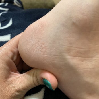 Allure Nails - Aftermath of one of our "relaxing" pedicures - Nail Salons Near Me - Mishawaka, Indiana Allure Nails - Aftermath of one of our "relaxing" pedicures - Nail Salons Near Me - Mishawaka, Indiana