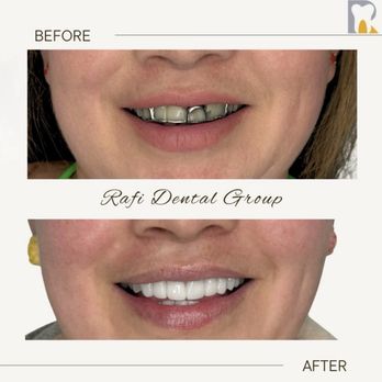 Rafi Dental Group - Cosmetic Dentists Near Me - Tustin, California Rafi Dental Group - Cosmetic Dentists Near Me - Tustin, California