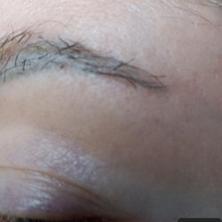 Bosley Hair Restoration & Transplant