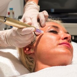 DERMAPEN ..Induccion de Colageno.   Tratamiento nutritivo y rejuvenecedor.