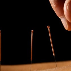 Rachel Lopez - Schedule an appointment to meet Bergen County's leading acupuncturist for pain management, fertility, stress and anxiety, and Bell's Palsy!