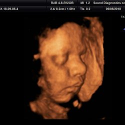 Bump 2 Baby & Beyond - 32 week profile