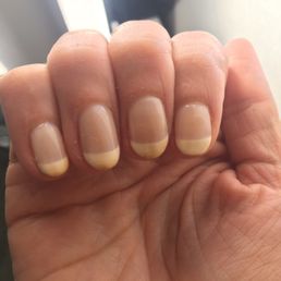 12 hrs after getting the Shellac Manicure