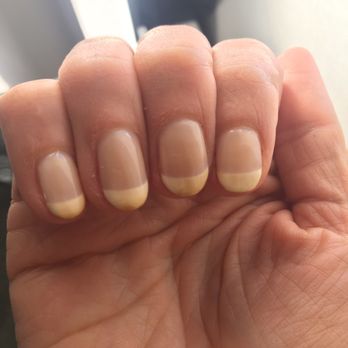 Bayside Nails - 12 hrs after getting the Shellac Manicure - Nail Salons Near Me - Kirkland, Washington