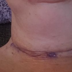 My neck