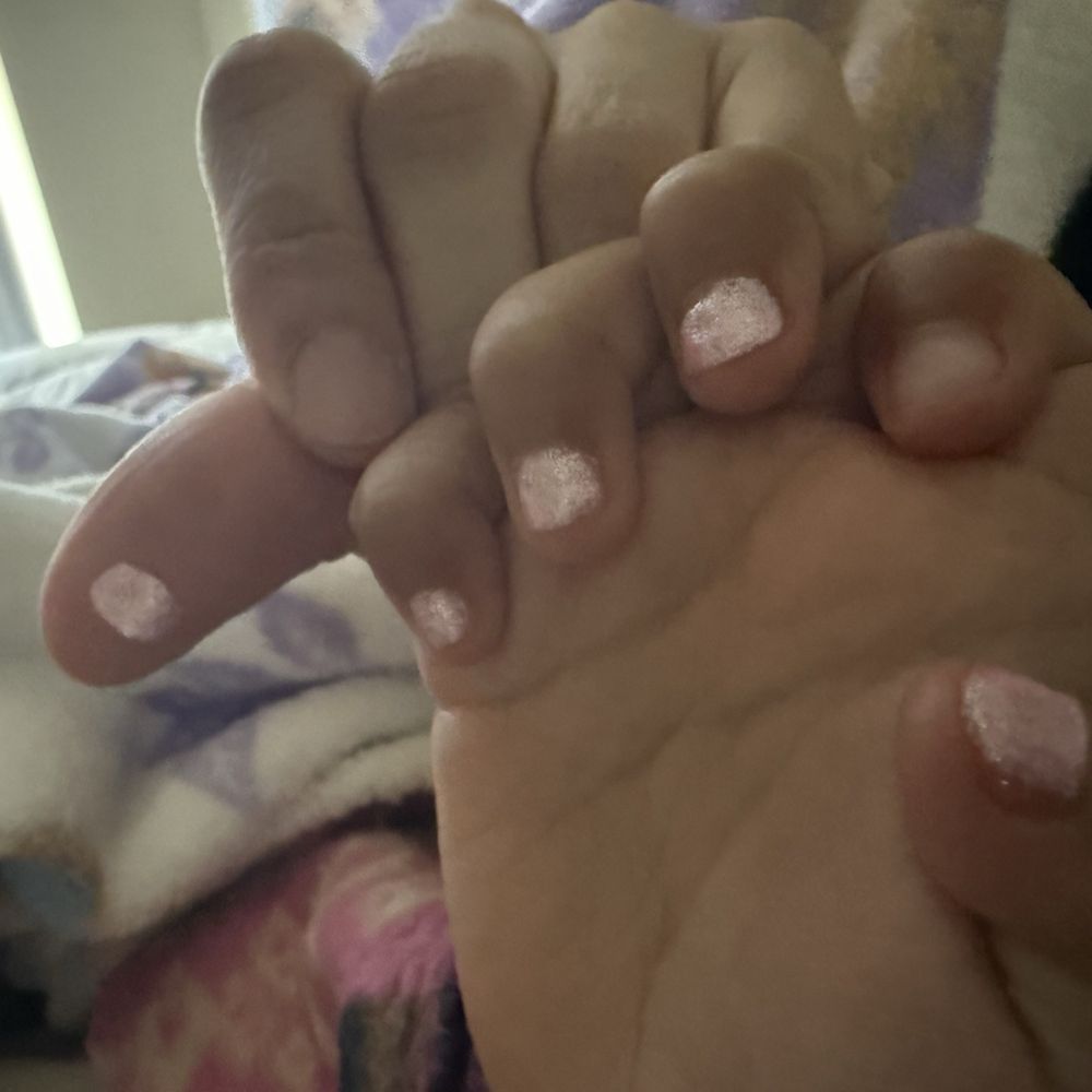 My daughters gel fell off 24 hrs later My daughters gel fell off 24 hrs later