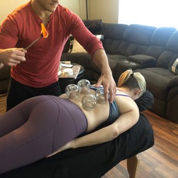 Viable Cupping - Traditional Chinese Medicine Near Me Viable Cupping - Traditional Chinese Medicine Near Me