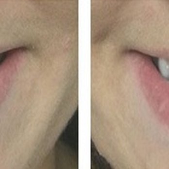 Prairie Dental Group - Cosmetic Surgeons Near Me - Springfield, Illinois Prairie Dental Group - Cosmetic Surgeons Near Me - Springfield, Illinois